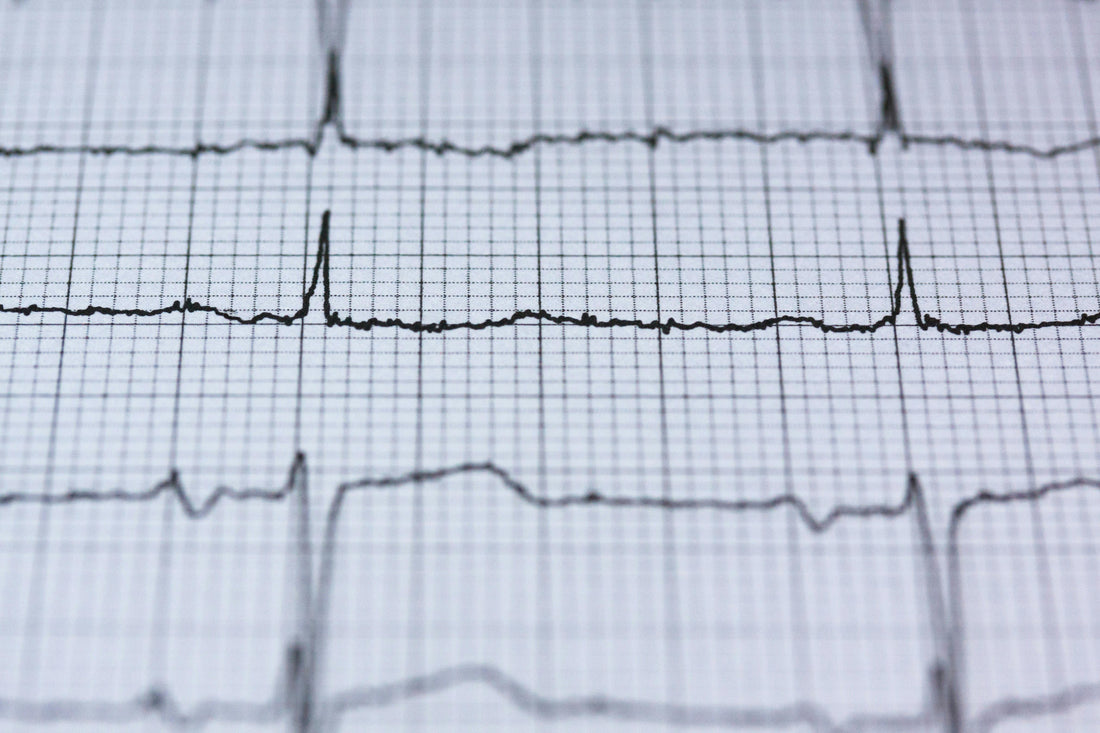 What Is Heart Rate Variability? (And How to Train It)